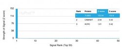 beta-III Tubulin Antibody (TUBB3/3732) - Azide and BSA Free, Novus Biologicals